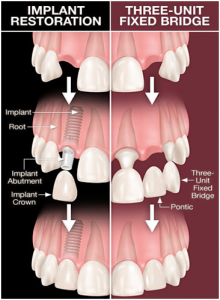 dental_impacts_2